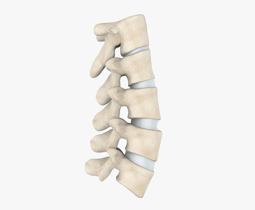 Lumbar Facet Cyst Treatment