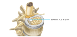 bone infographic
