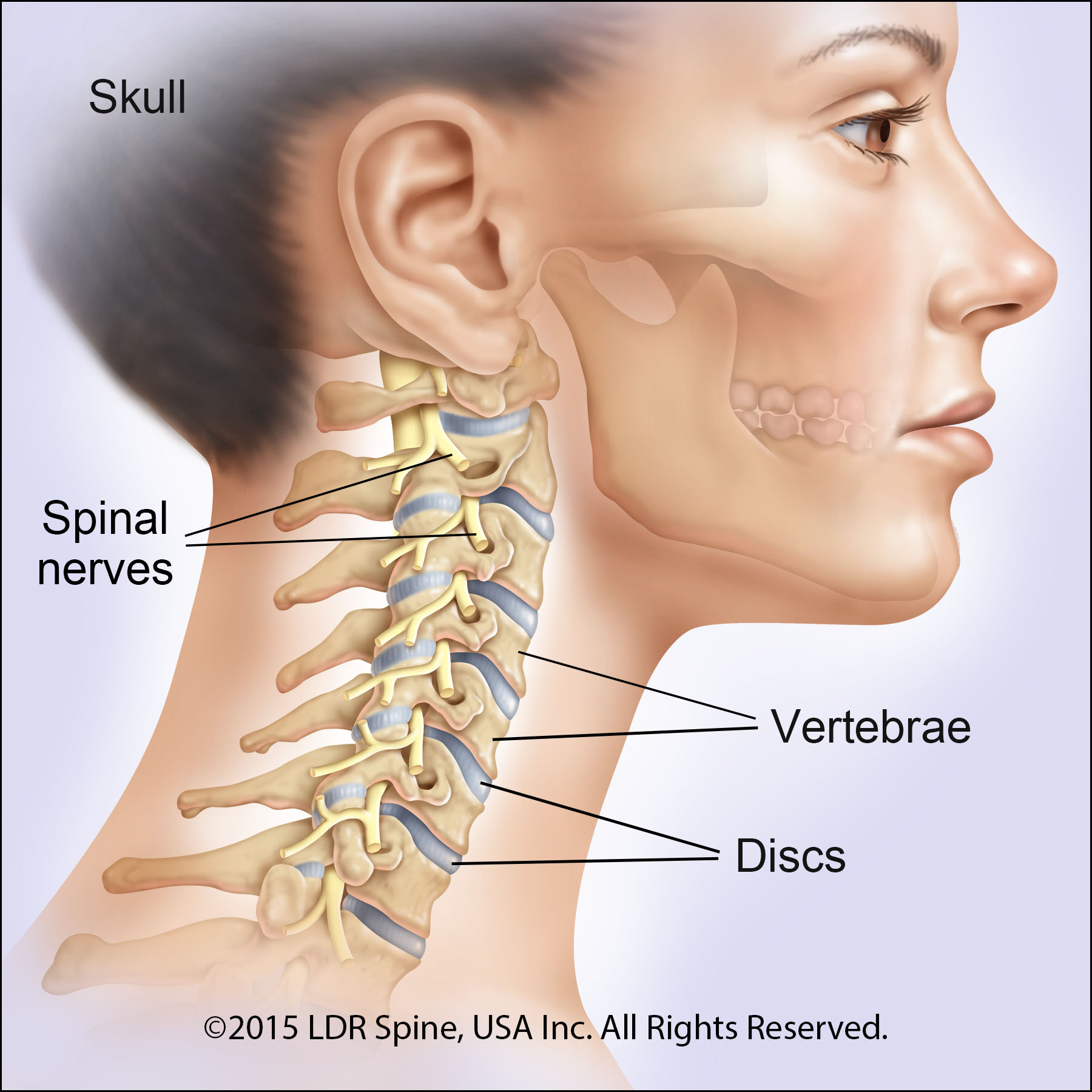 Mobi-C Cervical Disc